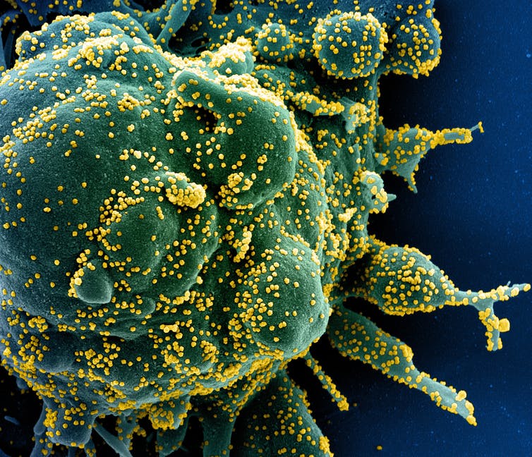 Los tres tests del coronavirus que (juntos) nos ayudarán a controlar la pandemia
