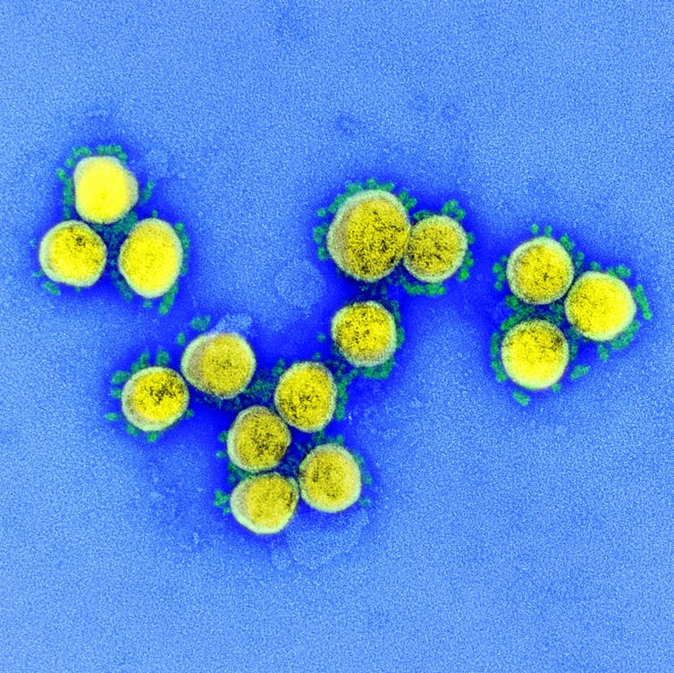 El virus de la COVID-19 ni se creó ni se escapó de un laboratorio